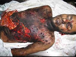 DIME weapons were first used against Gaza by Israeli drones in the summer of 2006, when Palestinian medical personnel reported that it significantly increased the fatality rate among victims. Shortly after the DIME weapons were also trialled during the first week of the war in Lebanon in July 2006.