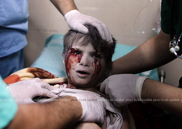 A Palestinian boy, who medics said was wounded by Israeli shelling, receives treatment at al-Shifa hospital in Gaza City July 20, 2014. At least 20 Palestinians were killed on Sunday by Israeli shelling in a Gaza neighbourhood, where bodies were strewn in the street and thousands fled toward the hospital packed with wounded, witnesses and health officials said. The mass casualties in the Shejaia district in northeast Gaza appeared to be the heaviest since Israel launched its offensive on the Palestinian territory on July 8 after cross-border rocket strikes by militants intensified. Militants kept up their rocket fire on Israel, with no sign of a diplomatic breakthrough toward a ceasefire in sight. (Photo/Ali Jadallah)