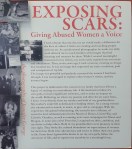 Domestic Violence Expossing&nbsp;Scars